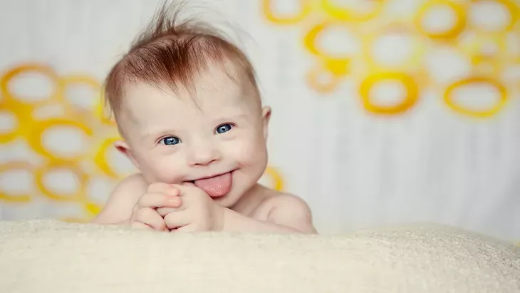 perilaku bayi down syndrome