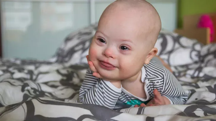 perilaku bayi down syndrome