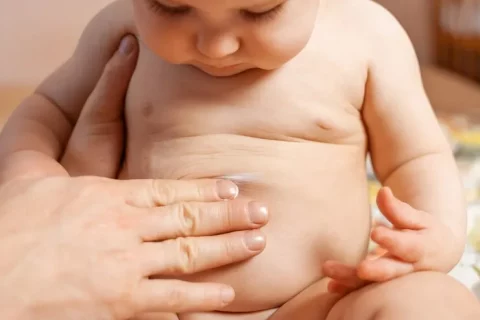cara mengatasi perut kembung pada bayi