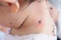 cara menghilangkan bekas gigitan nyamuk pada bayi