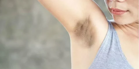 ketiak hitam saat hamil