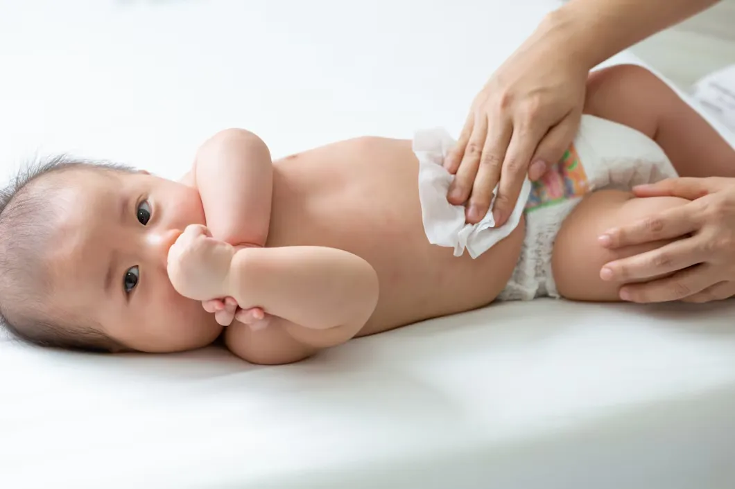 cara mengatasi ruam popok pada bayi