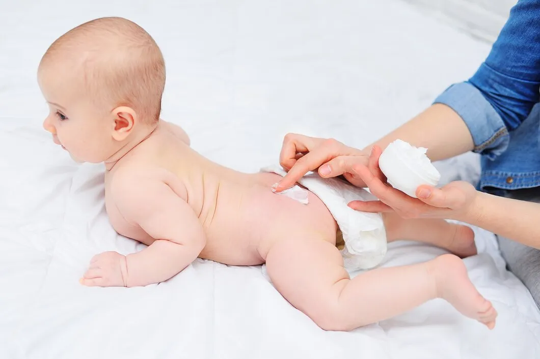 cara mengatasi ruam popok pada bayi