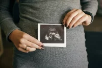 perbedaan hasil usg bayi laki-laki dan perempuan