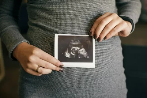 perbedaan hasil usg bayi laki-laki dan perempuan