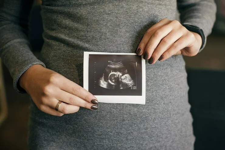perbedaan hasil usg bayi laki-laki dan perempuan