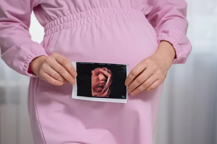 perbedaan hasil usg bayi laki-laki dan perempuan